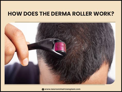 how to use derma roller, How to use derma roller at home