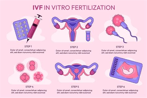 in vitro fertilization