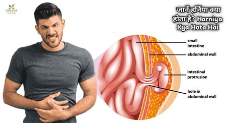 intercom kya hota hai, B.com kya hota hai