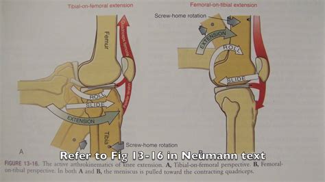 locking of the knee joint, عبدالسلام الشمري on twitter: 