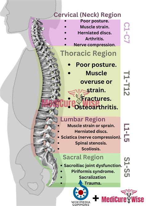Lower Back Pain Location Chart