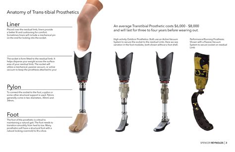 prosthesis