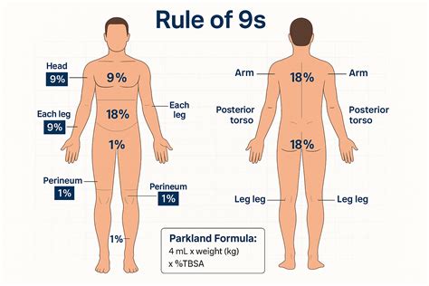 Rule Of 9 S Burn Chart