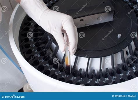 sample loading in discrete analyzer, Woman loading samples in analyzer stock image