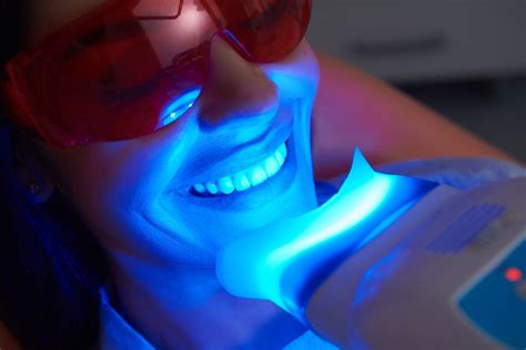 tandblekning plasmaljus