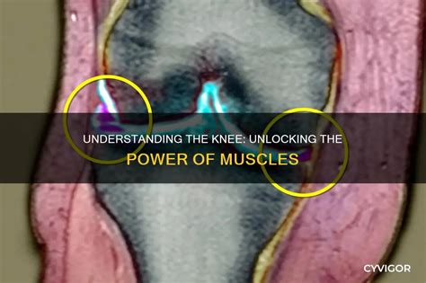unlocking muscle of knee, The knee unlocking muscle