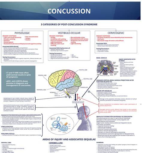 ur Concussion