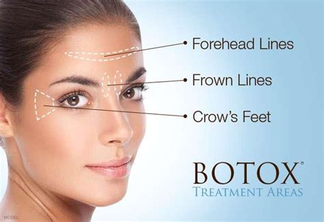 vad är botox