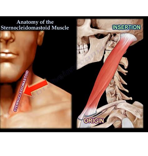 what is the function of the sternocleidomastoid muscle, Function of the sternocleidomastoid muscle